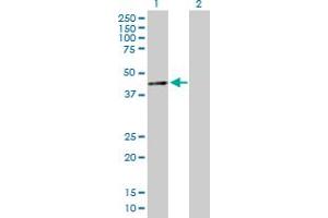 Western Blot analysis of SIN3B expression in transfected 293T cell line by SIN3B MaxPab polyclonal antibody. (SIN3B anticorps  (AA 1-353))