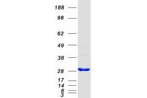Validation with Western Blot