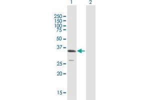 Western Blot analysis of ULBP1 expression in transfected 293T cell line by ULBP1 MaxPab polyclonal antibody. (ULBP1 anticorps  (AA 1-244))