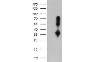 HEK293T cells were transfected with the pCMV6-ENTRY control (Left lane) or pCMV6-ENTRY ERCC1 (Right lane) cDNA for 48 hrs and lysed. (ERCC1 anticorps)