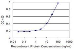 Detection limit for recombinant GST tagged ZIC4 is 0.