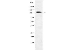 Western blot analysis of MAGE1 using K562 whole cell lysates (MAGEE1 anticorps  (Internal Region))