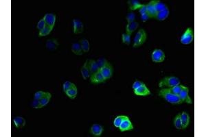 Immunofluorescent analysis of MCF-7 cells using ABIN7156574 at dilution of 1:100 and Alexa Fluor 488-congugated AffiniPure Goat Anti-Rabbit IgG(H+L) (IFI27L2 anticorps  (AA 87-130))