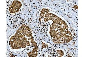IHC analysis of SNRPN using anti-SNRPN antibody (ABIN3043934). (SNRPN anticorps  (N-Term))