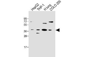 All lanes : Anti-FCGRT Antibody (C-term) at 1:500 dilution Lane 1: HepG2 whole cell lysate Lane 2: THP-1 whole cell lysate Lane 3: Human lung lysate Lane 4: COLO 205 whole cell lysate Lysates/proteins at 20 μg per lane. (FcRn anticorps  (C-Term))