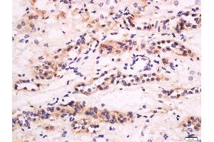 Formalin-fixed and paraffin embedded human kidney labeled with Anti-CXCL14 Polyclonal Antibody, Unconjugated  at 1:200 followed by conjugation to the secondary antibody and DAB staining. (CXCL14 anticorps  (AA 51-99))
