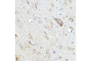 Immunohistochemistry of paraffin-embedded mouse spinal cord using HGF Rabbit pAb (ABIN3021682, ABIN3021683, ABIN3021684 and ABIN6215504) at dilution of 1:100 (40x lens).