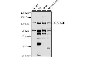 Western blot analysis of extracts of various cell lines, using CE antibody  at 1:1000 dilution. (CEACAM6 anticorps  (AA 200-320))