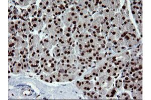 Image no. 5 for anti-tRNA Methyltransferase 2 Homolog A (TRMT2A) antibody (ABIN1501516)