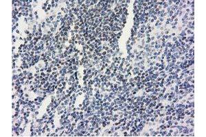 Image no. 1 for anti-Ankyrin Repeat Domain 53 (ANKRD53) (AA 1-300) antibody (ABIN1490718) (ANKRD53 anticorps  (AA 1-300))