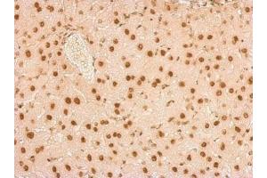 IHC-P Image SNRPA antibody detects SNRPA protein at nucleus on mouse liver by immunohistochemical analysis.