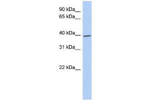 WB Suggested Anti-IKBKG Antibody Titration: 0.