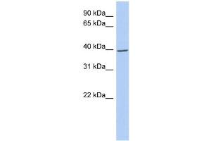 WB Suggested Anti-IKBKG Antibody Titration: 0. (IKBKG anticorps  (N-Term))