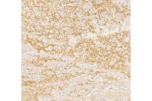 Immunohistochemistry analysis of paraffin embedded mouse cerebellum using Nrg4 (ABIN7074805) at dilution of 1: 300