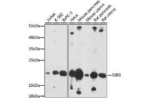 Western blot analysis of extracts of various cells, using SSR3 antibody (ABIN7270298) at 1:1000 dilution. (SSR3 anticorps  (AA 70-145))