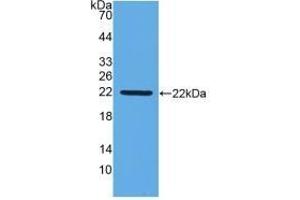 Detection of Recombinant IFNb, Gallus using Monoclonal Antibody to Interferon Beta (IFNb) (IFNB1 anticorps  (AA 27-203))