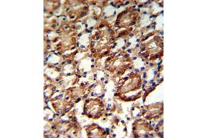 Immunohistochemistry (IHC) image for anti-Guanine Monophosphate Synthetase (GMPS) antibody (ABIN3001740) (GMP Synthase anticorps)