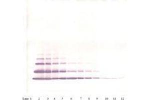 Image no. 2 for anti-Chemokine (C-X-C Motif) Ligand 2 (CXCL2) antibody (ABIN465915) (CXCL2 anticorps)