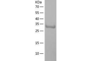 Western Blotting (WB) image for Ankyrin Repeat Domain 1 (Cardiac Muscle) (ANKRD1) (AA 1-319) protein (His tag) (ABIN7121837) (ANKRD1 Protein (AA 1-319) (His tag))