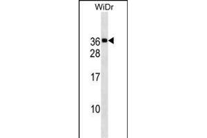 MED30 Antibody (Center) (ABIN1537737 and ABIN2838170) western blot analysis in WiDr cell line lysates (35 μg/lane). (MED30 anticorps  (AA 107-133))