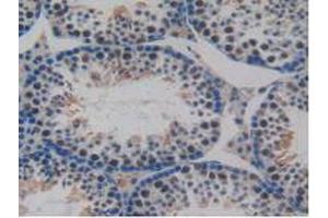 IHC-P analysis of Mouse Testis Tissue, with DAB staining.