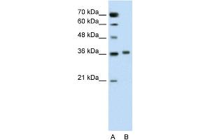 WB Suggested Anti-PIPOX Antibody Titration:  0. (PIPOX anticorps  (C-Term))