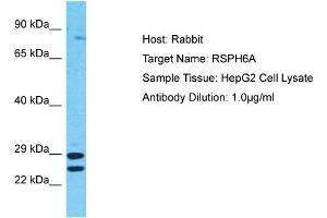 Host: Rabbit Target Name: RSPH6A Sample Tissue: Human HepG2 Whole Cell Antibody Dilution: 1ug/ml (RSPH6A anticorps  (C-Term))