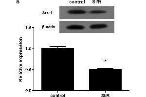 Down-regulation of Srx-1 in H9c2 cardiomyocytes under SI/R treatmentThe H9c2 cells were exposed to hypoxia for 10 h and then reoxygenated for 3 h.