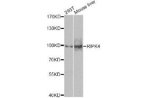 Western blot analysis of extracts of various cell lines, using RIPK4 antibody (ABIN5974690) at 1/1000 dilution.
