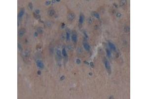 Used in DAB staining on fromalin fixed paraffin- embedded Kidney tissue