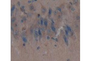 Used in DAB staining on fromalin fixed paraffin- embedded Kidney tissue (IDS anticorps  (AA 107-363))