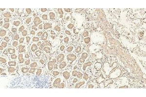 Immunohistochemistry of paraffin-embedded Human stomach tissue using CD4 Monoclonal Antibody at dilution of 1:200. (CD4 anticorps)