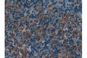 Detection of ACP5 in Rat Uterus Tissue using Polyclonal Antibody to Acid Phosphatase 5, Tartrate Resistant (ACP5)