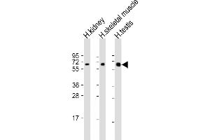 All lanes : Anti-DMRT2 Antibody (Center) at 1:2000 dilution Lane 1: human kidney lysate Lane 2: human skeletal muscle lysate Lane 3: human testis lysate Lysates/proteins at 20 μg per lane. (DMRT2 anticorps  (AA 357-392))