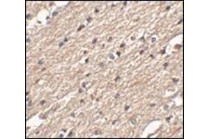 Immunohistochemistry of Spred3 in human brain tissue with this product at 2. (SPRED3 anticorps  (Center))