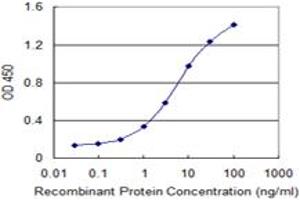 Detection limit for recombinant GST tagged DCLK1 is 0.