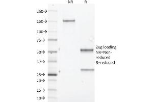 SDS-PAGE Analysis Purified Aurora B Mouse Monoclonal Antibody (AURKB/1845).