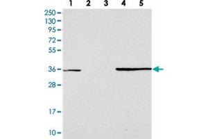 Western blot analysis of Lane 1: RT-4, Lane 2: U-251 MG, Lane 3: Human Plasma, Lane 4: Liver, Lane 5: Tonsil with FAM98C polyclonal antibody  at 1:250-1:500 dilution. (FAM98C anticorps)