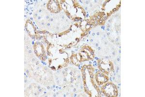 Immunohistochemistry of paraffin-embedded rat kidney using PTP4 antibody (ABIN7269703) at dilution of 1:100 (40x lens).