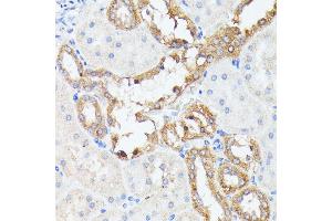 Immunohistochemistry of paraffin-embedded rat kidney using PTP4 antibody (ABIN7269703) at dilution of 1:100 (40x lens). (PTP4A2 anticorps  (AA 30-100))