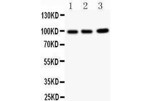 Western Blotting (WB) image for anti-erythrocyte Membrane Protein Band 4.1-Like 1 (EPB41L1) (AA 691-881) antibody (ABIN3042373) (EPB41L1 anticorps  (AA 691-881))