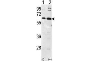 Western blot analysis of Ubiquilin-1 antibody and 293 cell lysate (2 ug/lane) either nontransfected (Lane 1) or transiently transfected with the Ubiquilin1 gene (2). (Ubiquilin 1 anticorps  (AA 40-70))
