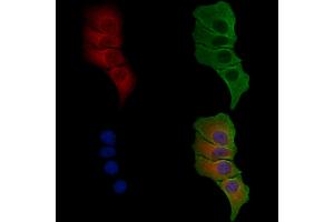 ABIN6258671 and ABIN6275143 staining Hela cells by IF/ICC.