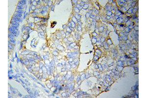 Immunohistochemistry (IHC) image for anti-C-Reactive Protein (CRP) (AA 1-224) antibody (ABIN3020716) (CRP anticorps  (AA 1-224))