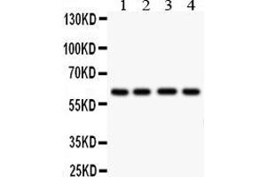 Anti- HEXA antibody, Western blottingAll lanes: Anti HEXA  at 0. (Hexosaminidase A anticorps  (C-Term))