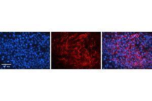 Rabbit Anti-PGRC2 Antibody   Formalin Fixed Paraffin Embedded Tissue: Human Testis Tissue Observed Staining: Plasma membrane in spermatozoa Primary Antibody Concentration: 1:100 Other Working Concentrations: 1:600 Secondary Antibody: Donkey anti-Rabbit-Cy3 Secondary Antibody Concentration: 1:200 Magnification: 20X Exposure Time: 0.