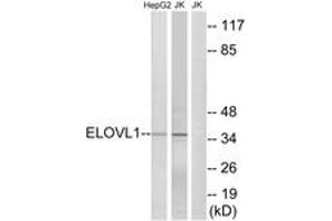 Western blot analysis of extracts from Jurkat/HepG2 cells, using ELOVL1 Antibody. (ELOVL1 anticorps  (AA 101-150))