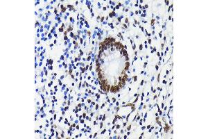 Immunohistochemistry of paraffin-embedded human appendix using K/TRIM28 antibody (ABIN7270986) at dilution of 1:100 (40x lens). (KAP1 anticorps)