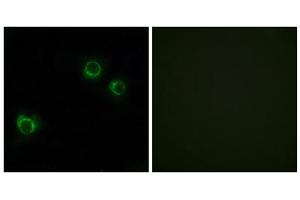 Immunofluorescence analysis of HUVEC cells, using CLDN6 antibody. (Claudin 6 anticorps  (Internal Region))