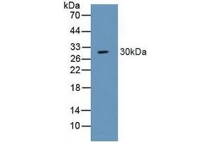 Detection of SCNN1a in Porcine Large Intestine Tissue using Polyclonal Antibody to Amiloride Sensitive Sodium Channel Subunit Alpha (SCNN1a)